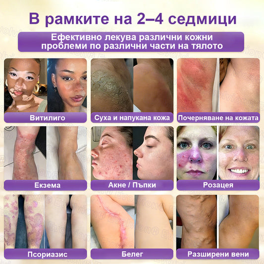 CleraNaure® Биотин 10-в-1 Възстановяващ крем за кожа