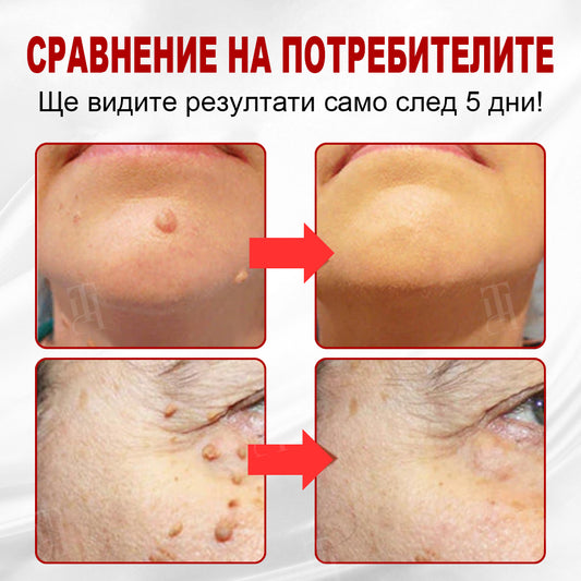 CleraNature® WartAway Pro лепенки.