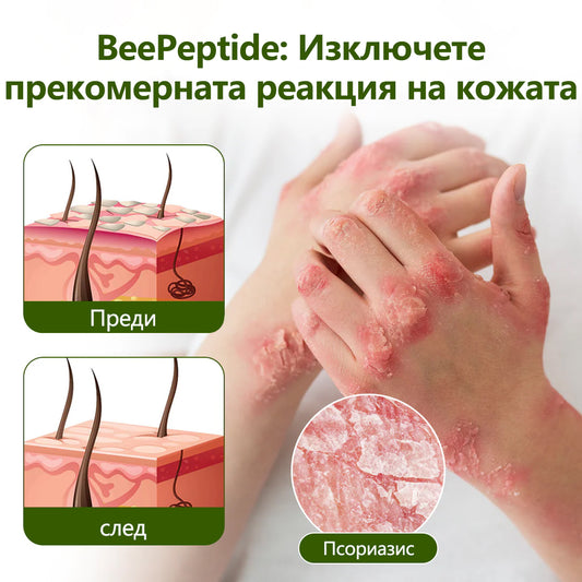 CleraNaure® BeePeptide RootSoft Крем за двойно облекчение