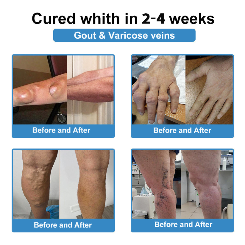 CleraNaure® Нано-микроиглен пластир за стави