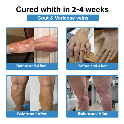 CleraNaure® Нано-микроиглен пластир за стави