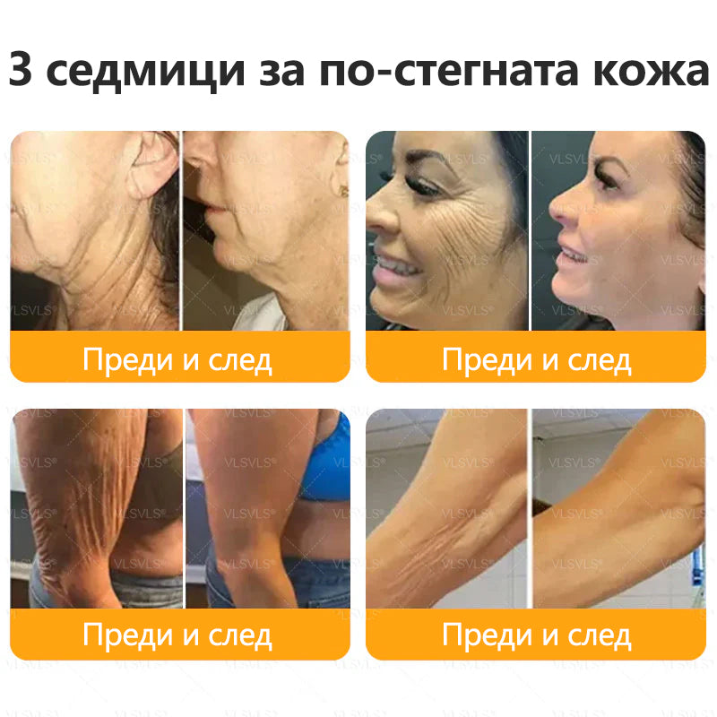 CleraNaure® Крем за възстановяване на кожата с пчелен отров