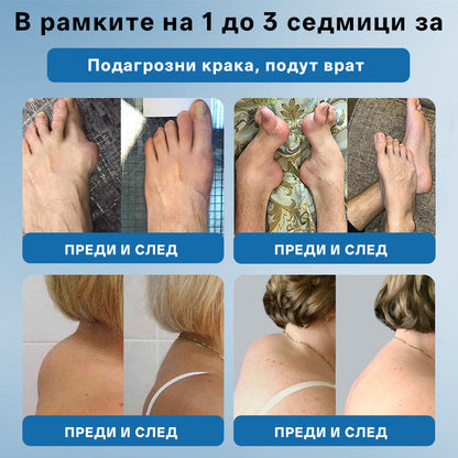 🥇CleraNaure® BPC-157 Крем за Лечение на Ставите 🦴 Лекува Артрит, Невропатия, Ревматизъм, Спортни Травми и други