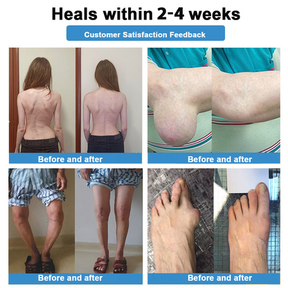 CleraNaure® Нано-микроиглен пластир за стави