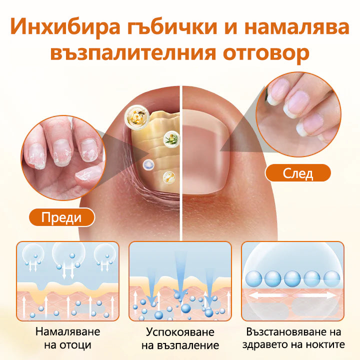 CleraNaure® FungiBee Напреднал Спрей за Ремонт на Нокти