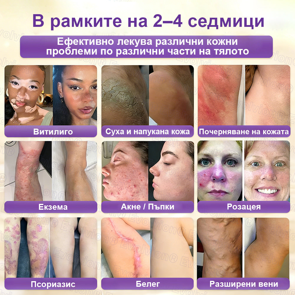 CleraNaure® Биотин 10-в-1 Възстановяващ крем за кожа