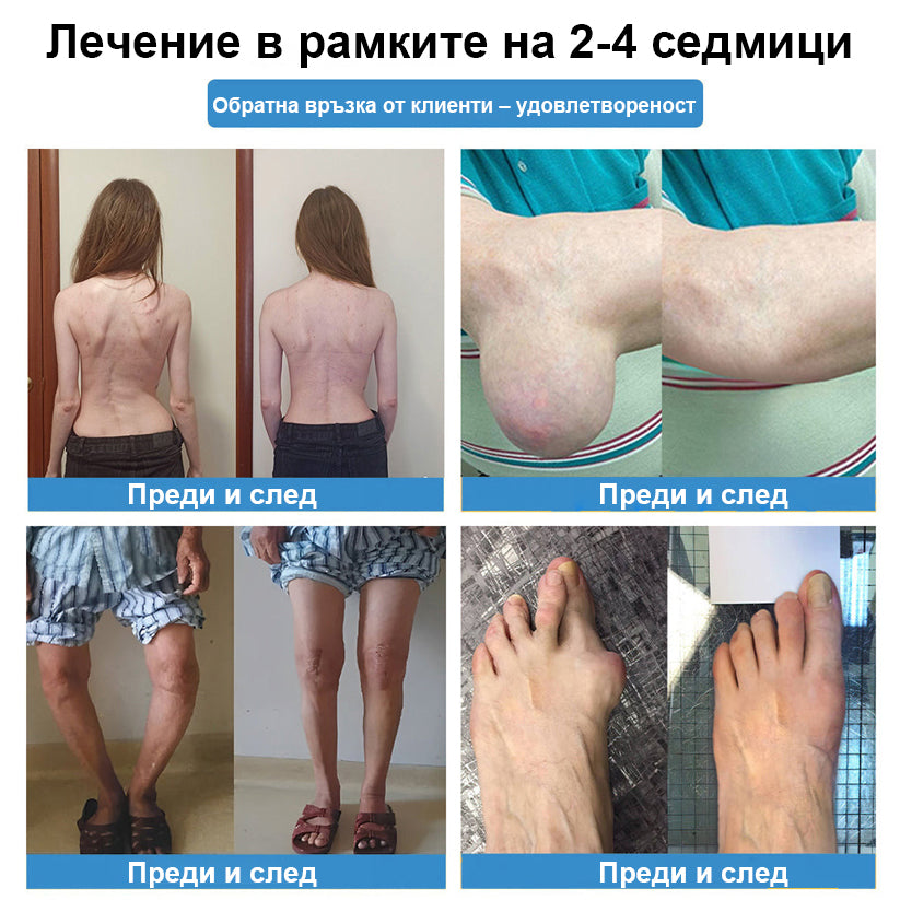 🏅CleraNaure® Нано-микроиглен пластир за стави