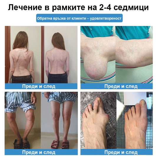 CleraNaure® Нано-микроиглен пластир за стави
