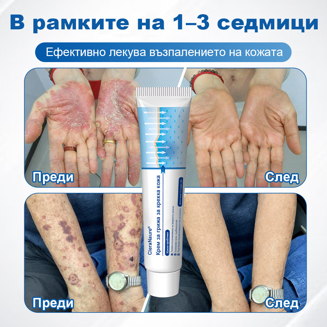 CleraNaure® Крем за възстановяване на чувствителна кожа 🌿 Мулти-възстановяване при натъртвания, сухота и петна