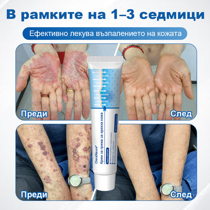 CleraNaure® Крем за възстановяване на чувствителна кожа 🌿 Мулти-възстановяване при натъртвания, сухота и петна