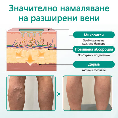 CleraNaure® LegRenew за варикозни вени