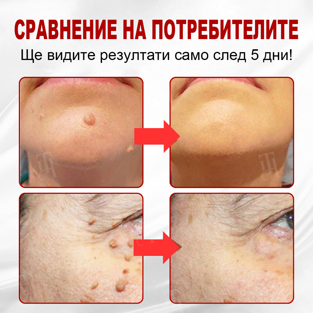 CleraNature® WartAway Pro лепенки.