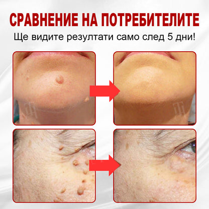 CleraNature® WartAway Pro лепенки.