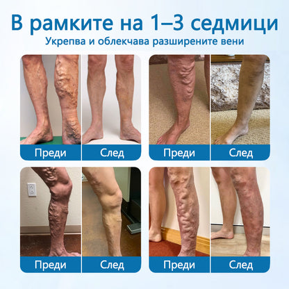 CleraNature® Билков спрей за вени