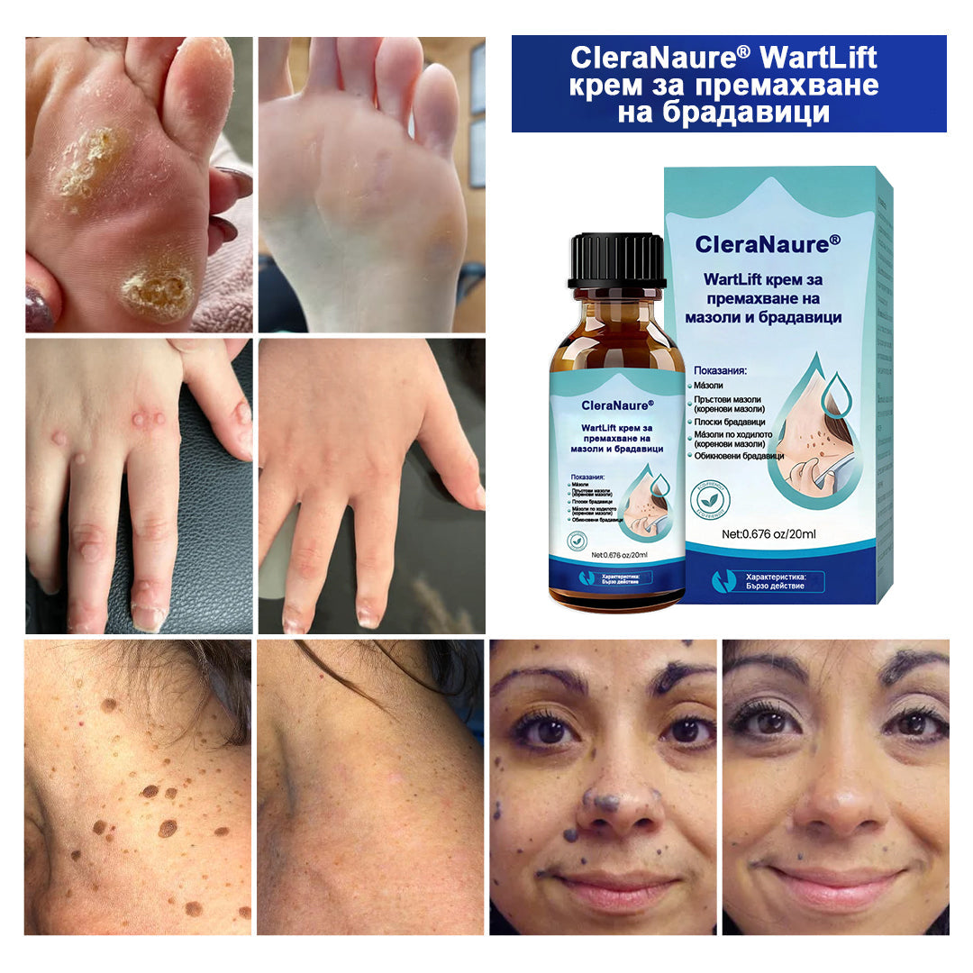🥇CleraNaure® WartLift течност за премахване на мазоли