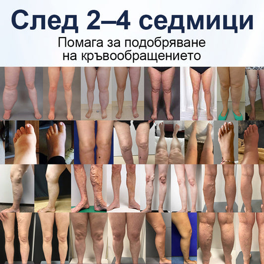 🌟CleraNaure® SwellRelief крем за подпомагане на кръвообращението