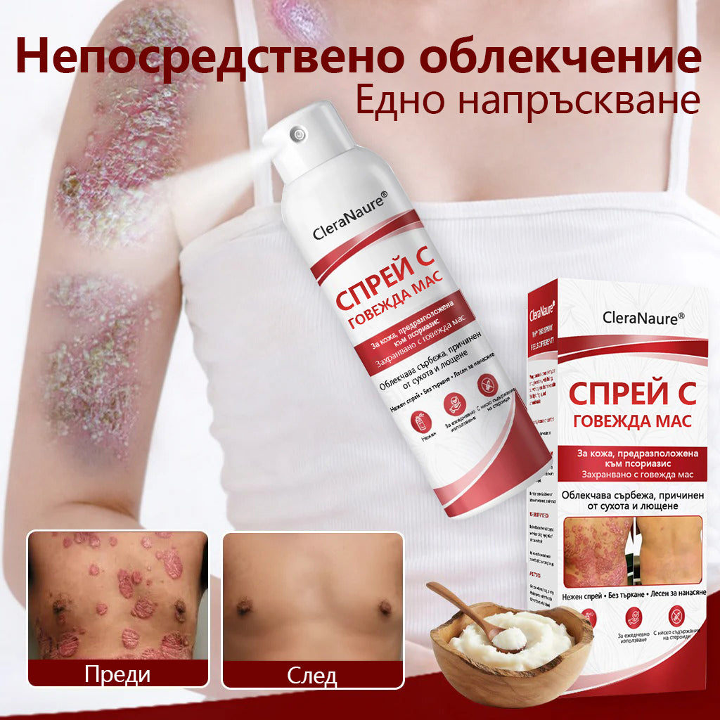 🥇CleraNature® Beef Tallow Spray за сърбяща, лющеща се кожа от псориазис🥇