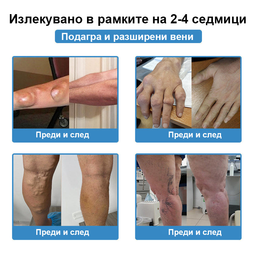 🏅CleraNaure® Нано-микроиглен пластир за стави