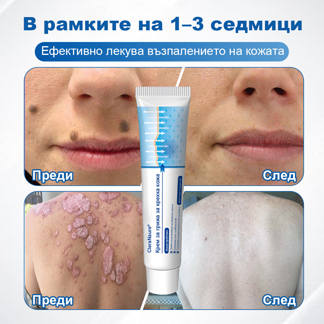 CleraNaure® Крем за възстановяване на чувствителна кожа 🌿 Мулти-възстановяване при натъртвания, сухота и петна