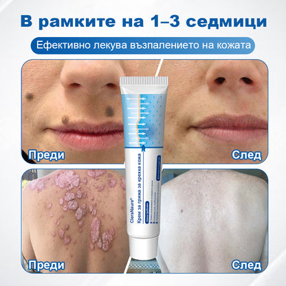 CleraNaure® Крем за възстановяване на чувствителна кожа 🌿 Мулти-възстановяване при натъртвания, сухота и петна