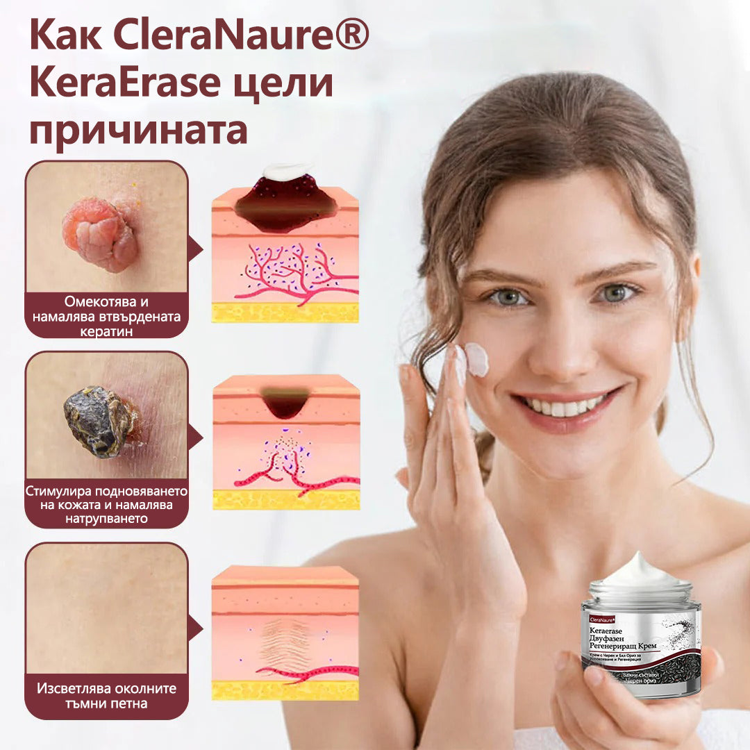 ⭐🏅 Официален магазин CleraNaure® KeraErase - Крем с двойно действие за подмладяване на кожата (Подмладяване с двойно действие – омекотява издигнатите бучки и разлага дълбокото натрупване на кератин без киселини и раздразнения)