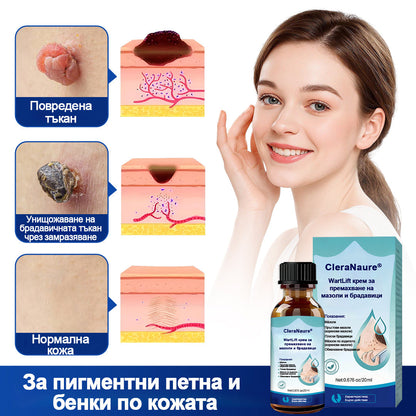 🥇CleraNaure® WartLift течност за премахване на мазоли