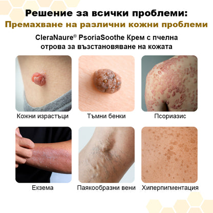 CleraNaure® PsoriaSoothe – Възстановяващ крем с пчелна отрова за кожа, склонна към псориазис