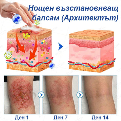 🥇CleraNaure® Дневна и Нощна Ремонтна Система за Екзема – 100% Безстероиден Дует за Облекчение при Силен Сърбеж, Зачервяване и Разранена Кожа (Оферта)