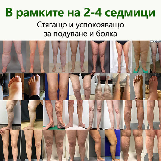 Кажете сбогом на подутите и болезнени крака – CleraNaure® FluidEase Професионален крем за кръвообращение в краката носи истинско облекчение! ✨🦵