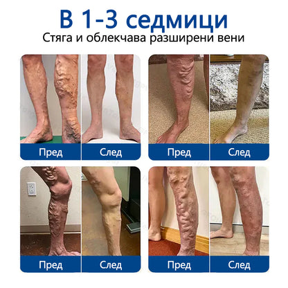 🥇Healrize® VeinTarget Микроиглен пластир