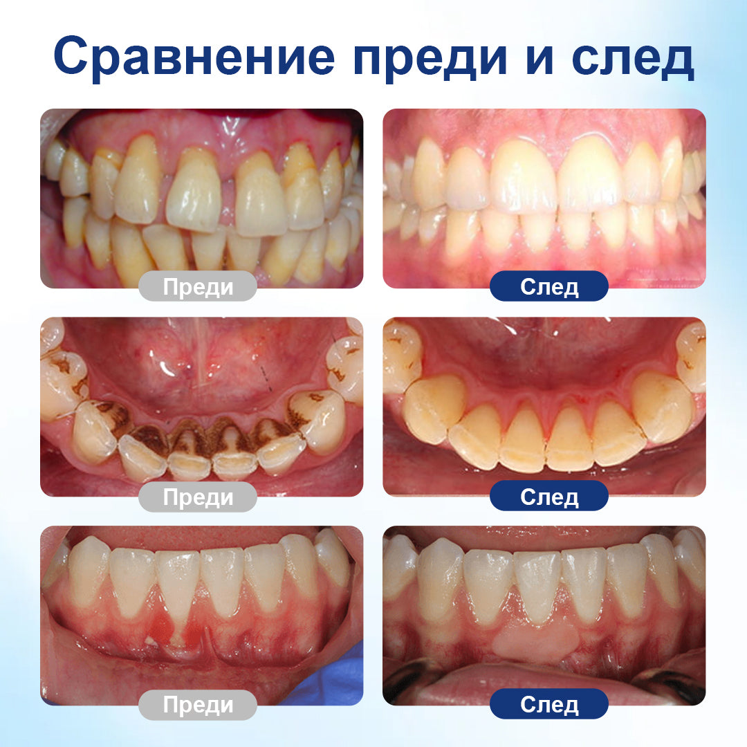 COLTURE® GumHoney – Капки за възстановяване на устната кухина