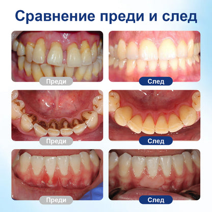 COLTURE® GumHoney – Капки за възстановяване на устната кухина