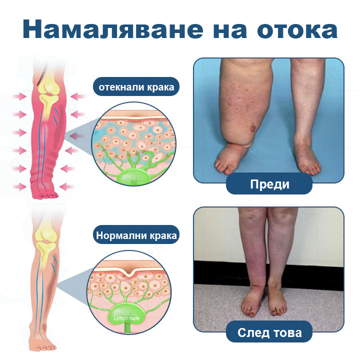 CleraNaure® Рол-он крем за лимфен дренаж и облекчаване на отоци