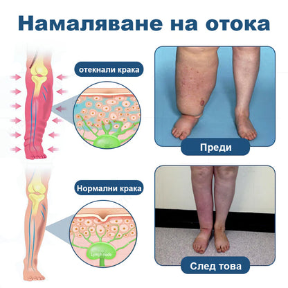 CleraNaure® Рол-он крем за лимфен дренаж и облекчаване на отоци