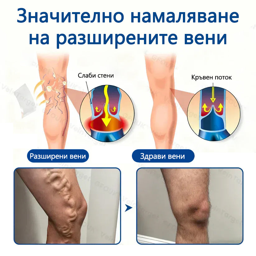 🥇Healrize® VeinTarget Микроиглен пластир