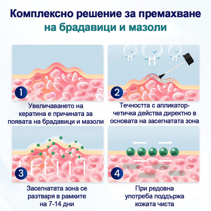 🥇CleraNaure® WartLift течност за премахване на мазоли