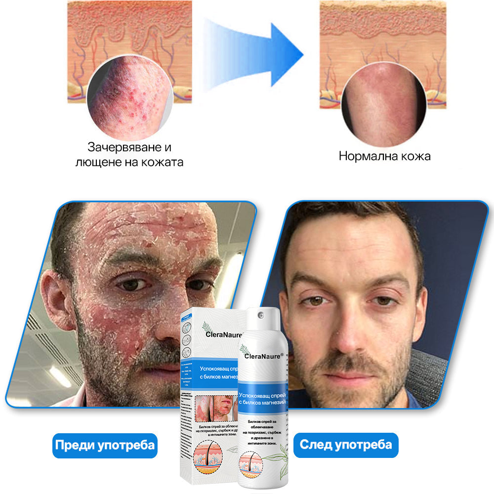 🫧CleraNature® Магнезиев спрей – Бързо облекчение за сърбяща, зачервена и чувствителна кожа (включително интимни зони)