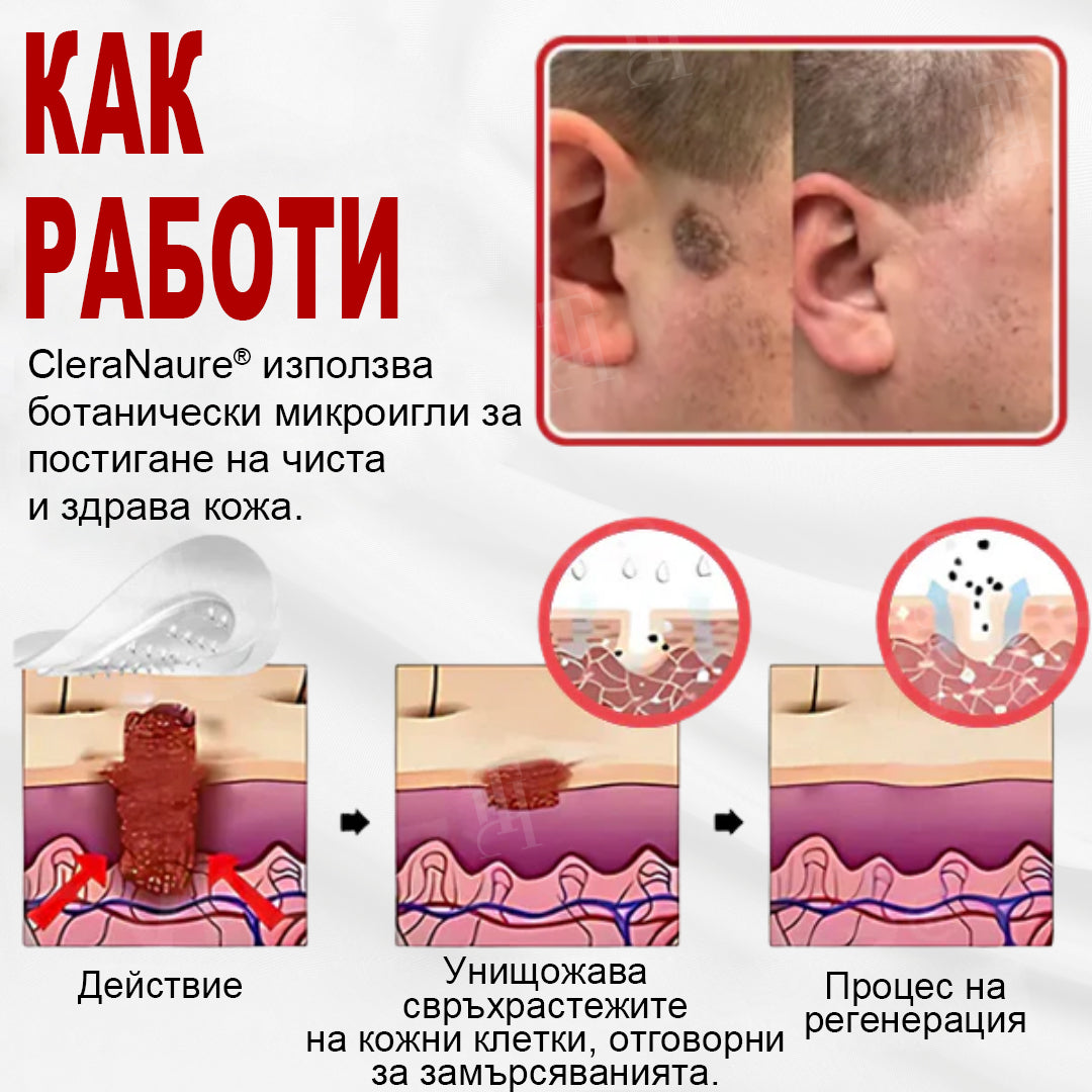 CleraNature® WartAway Pro лепенки.