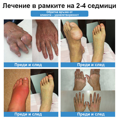 🏅CleraNaure® Нано-микроиглен пластир за стави