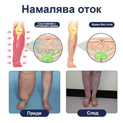 🔥CleraNaure® SwellRelief крем за подпомагане на кръвообращението