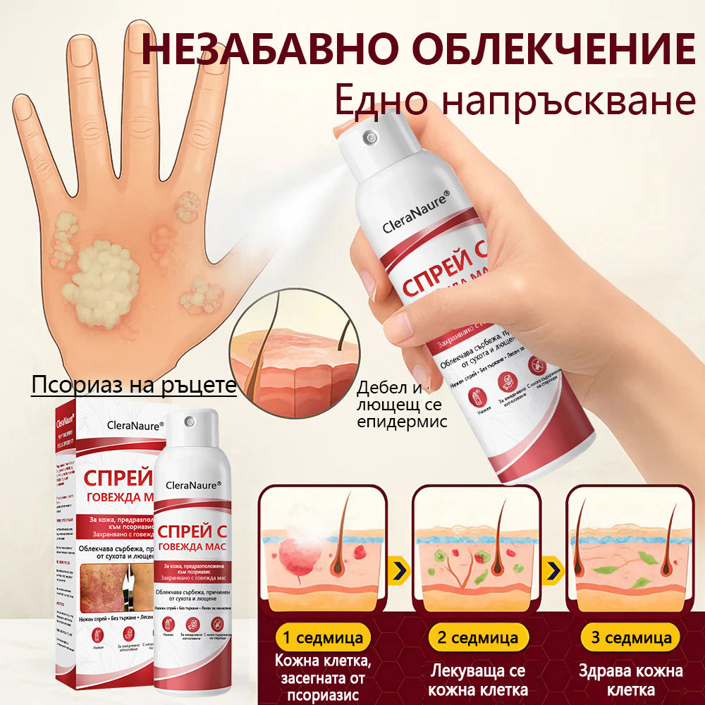 🥇CleraNature® Beef Tallow Spray за сърбяща, лющеща се кожа от псориазис🥇