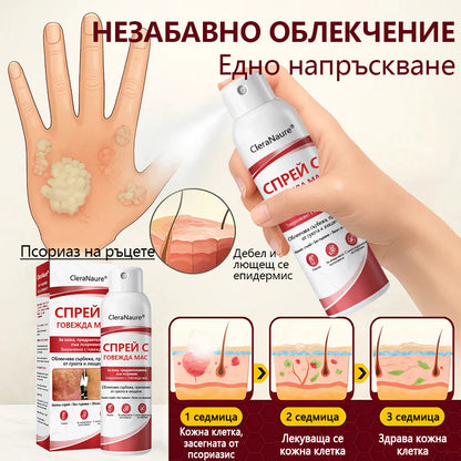 🥇CleraNature® Beef Tallow Spray за сърбяща, лющеща се кожа от псориазис🥇