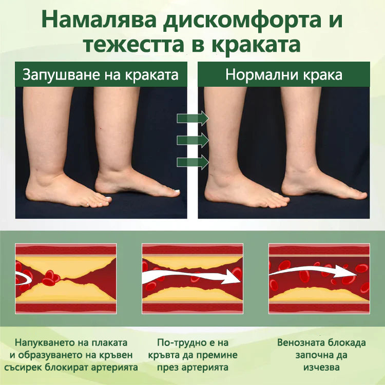 🌿 Кажете сбогом на подутите и болезнени крака – CleraNaure® FluidEase Професионален крем за кръвообращение в краката носи истинско облекчение! ✨🦵