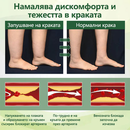 🌿 Кажете сбогом на подутите и болезнени крака – CleraNaure® FluidEase Професионален крем за кръвообращение в краката носи истинско облекчение! ✨🦵