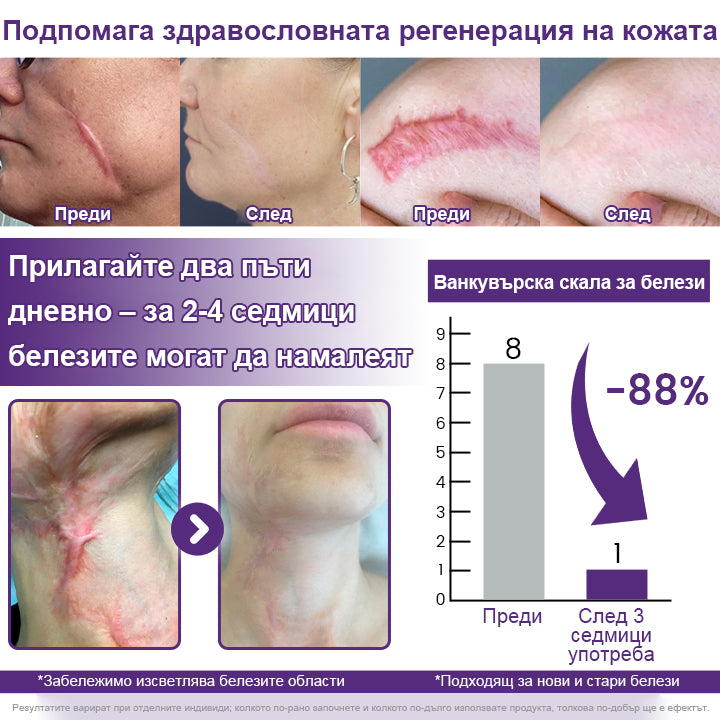 CleraNaure® ReGenScar гел с стволови клетки за белези