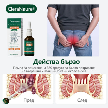 🎁 Ограничена по време оферта | CleraNaure® Бърз Хемороиден ПРО Спрей
