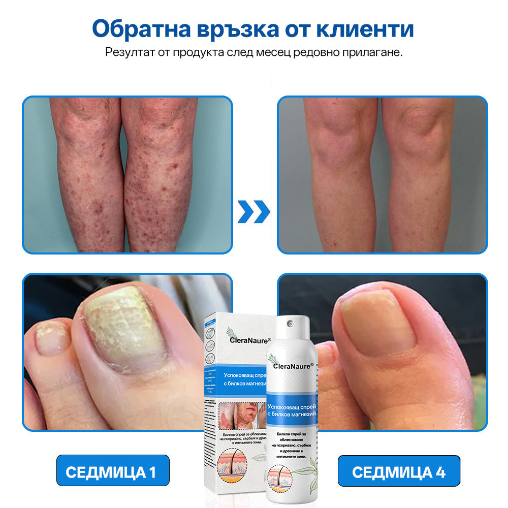 🫧CleraNature® Магнезиев спрей – Бързо облекчение за сърбяща, зачервена и чувствителна кожа (включително интимни зони)
