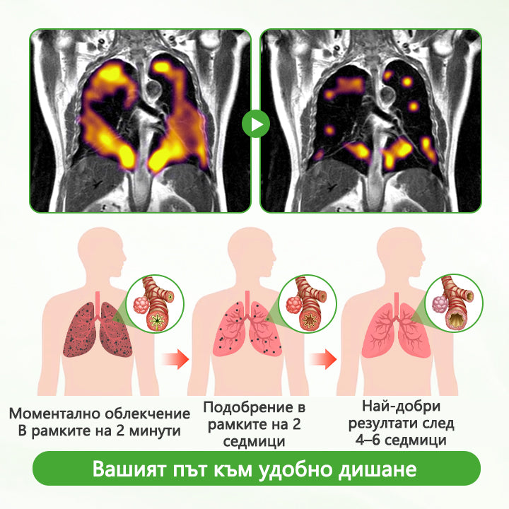 💎CleraNaure® HerbaAir Мулен Белодробен Пречистващ Препарат