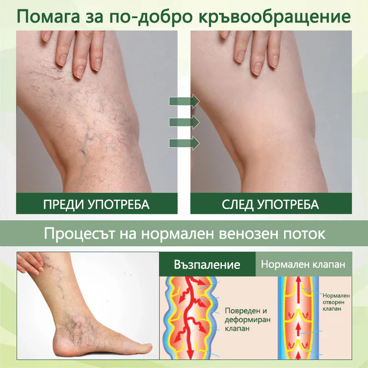 🌿 Кажете сбогом на подутите и болезнени крака – CleraNaure® FluidEase Професионален крем за кръвообращение в краката носи истинско облекчение! ✨🦵
