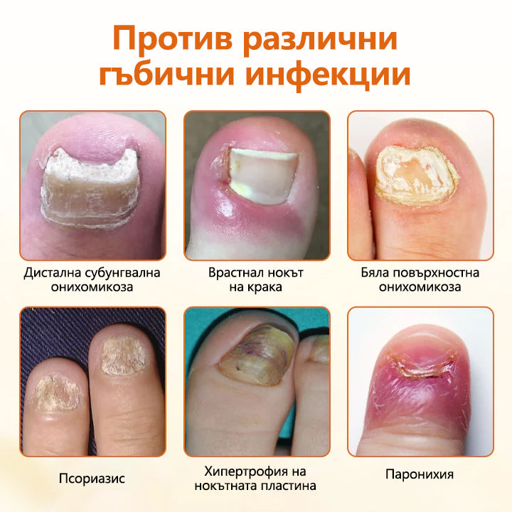 CleraNaure® FungiBee Напреднал Спрей за Ремонт на Нокти